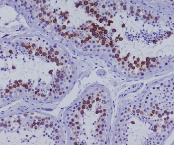 CD168 Rabbit mAb Antibody