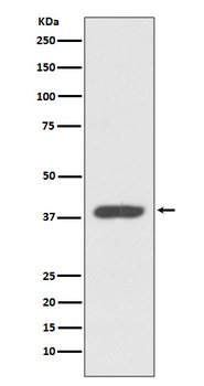 CXCR7 Rabbit mAb Antibody