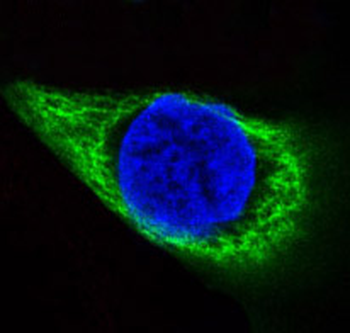 Cytokeratin 14 Rabbit Monoclonal Antibody