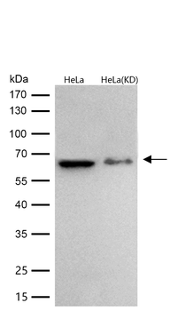 IRAK3 Rabbit mAb [KD Validated] Antibody