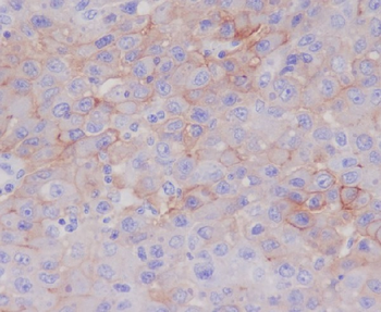 P Glycoprotein Rabbit mAb Antibody