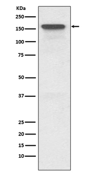 P Glycoprotein Rabbit mAb Antibody