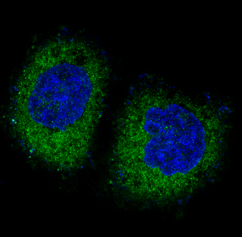 PKR Rabbit Monoclonal Antibody