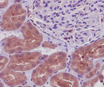 PKR Rabbit Monoclonal Antibody