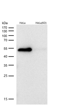 GAP43 Rabbit mAb [KD Validated] Antibody