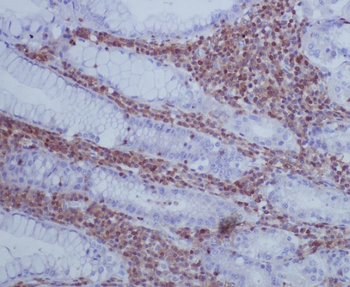 GAP43 Rabbit mAb [KD Validated] Antibody