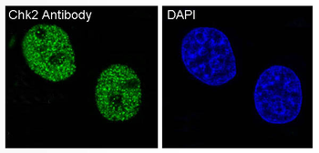 Chk2 Rabbit mAb [KD Validated] Antibody