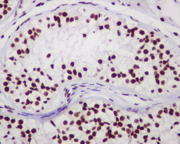 Chk2 Rabbit mAb [KD Validated] Antibody