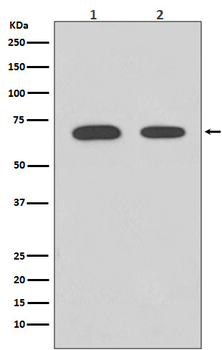 Chk2 Rabbit mAb [KD Validated] Antibody