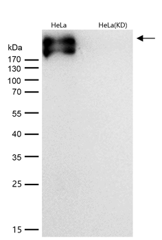 Fibronectin Rabbit mAb [KD Validated] Antibody