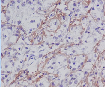 Fibronectin Rabbit mAb [KD Validated] Antibody
