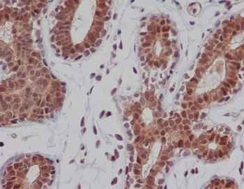 DNA-PKcs Rabbit mAb [KD Validated] Antibody