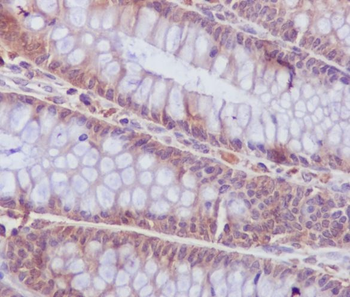 Caspase-6 Rabbit Monoclonal Antibody