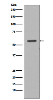 Tyrosine Hydroxylase Rabbit Monoclonal Antibody