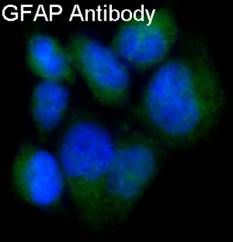 GFAP Rabbit mAb Antibody