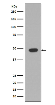 GFAP Rabbit mAb Antibody