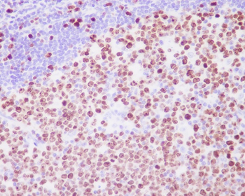 Ki67 Rabbit mAb Antibody