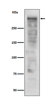 Ki67 Rabbit mAb Antibody