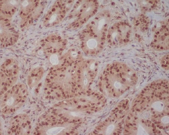 PI 3 Kinase p85 beta Rabbit mAb Antibody
