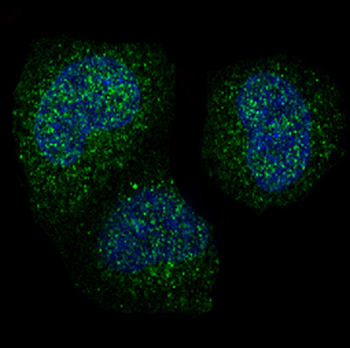 Cyclin B1 Rabbit mAb [KD Validated] Antibody