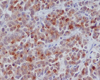 Cyclin B1 Rabbit mAb [KD Validated] Antibody