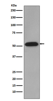 Cyclin B1 Rabbit mAb [KD Validated] Antibody