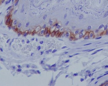 Collagen XVII Rabbit mAb Antibody