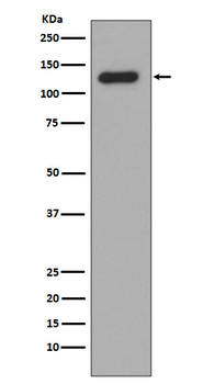 Collagen XVII Rabbit mAb Antibody