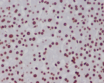 Histone H3 (mono methyl K18) Rabbit mAb Antibody