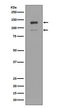 IFNAR1 Rabbit mAb Antibody