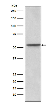 Src Rabbit mAb [KD Validated] Antibody