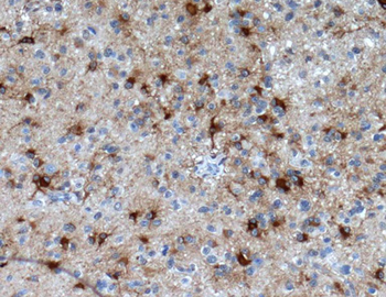 GFAP Rabbit mAb Antibody