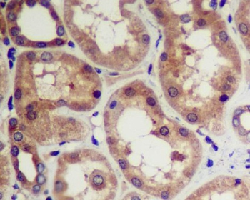 CDK5 Rabbit mAb Antibody