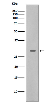 CDK5 Rabbit mAb Antibody
