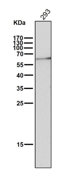 ELK1 Rabbit mAb Antibody
