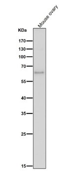 ELK1 Rabbit mAb Antibody