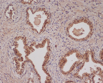 Bad Rabbit mAb Antibody