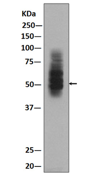 GLUT1 Rabbit Monoclonal Antibody