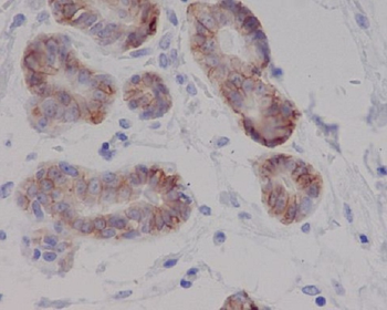 c-Kit Rabbit mAb Antibody