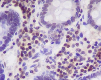 p27 KIP 1 Rabbit mAb [KD Validated] Antibody