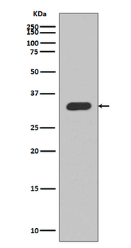 p27 KIP 1 Rabbit mAb [KD Validated] Antibody