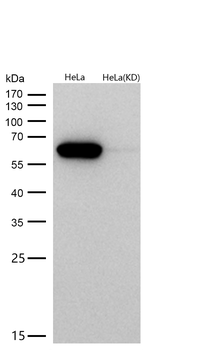 Calreticulin Rabbit mAb [KD Validated] Antibody