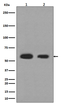 Calreticulin Rabbit mAb [KD Validated] Antibody
