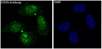 STAT6 Rabbit mAb Antibody
