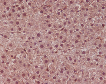 STAT6 Rabbit mAb Antibody