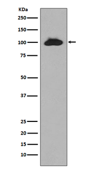 STAT6 Rabbit mAb Antibody