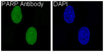 PARP Rabbit Monoclonal Antibody