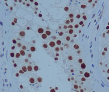 PARP Rabbit Monoclonal Antibody
