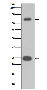 PARP Rabbit Monoclonal Antibody
