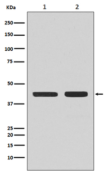CCR7 Rabbit mAb